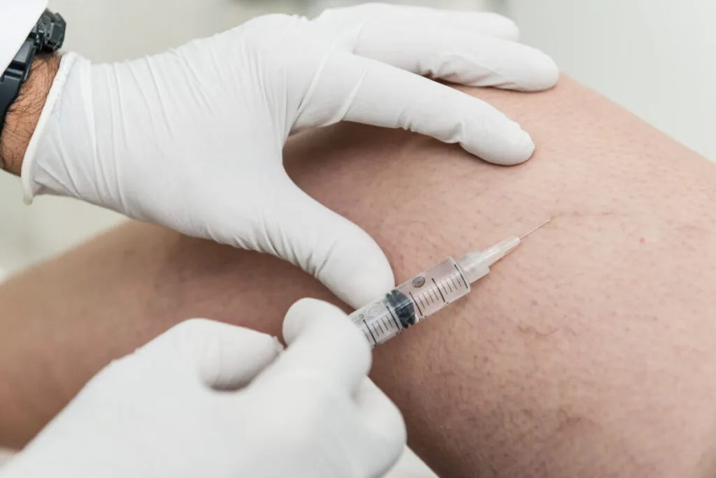 sclerotherapy on varicose veins performed by professional vein doctor
