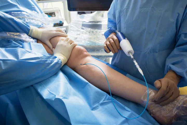 vein doctors treating a leg