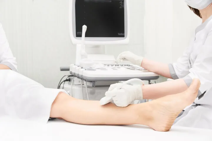 How Many Laser Treatments Are Needed to Remove Spider Veins?