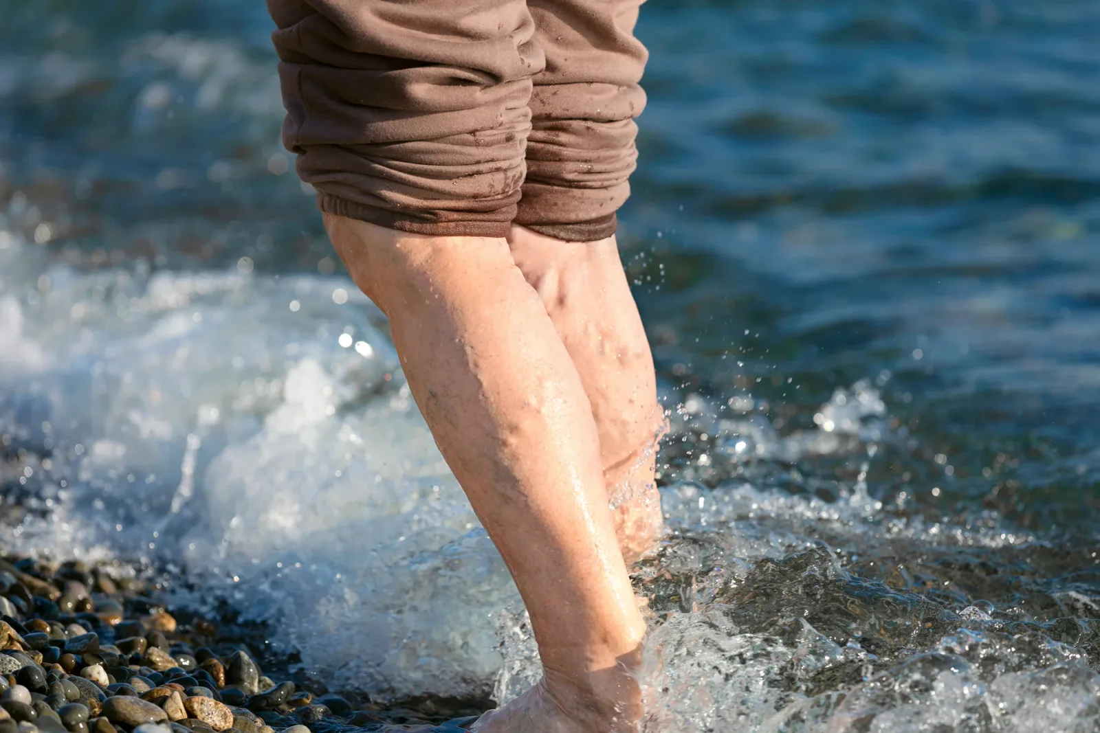 The Effects of Chronic Venous Insufficiency on Your Daily