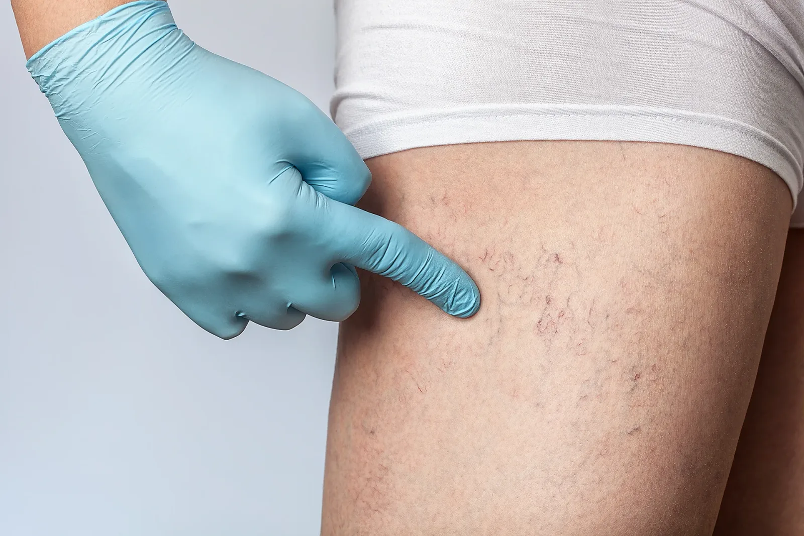 Here’s Why You Should Consider Ablation Treatment to Treat