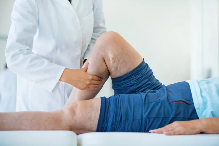 medical doctor consulting with patient about their spider veins